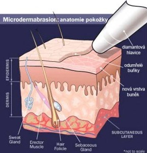 mikrodermabraze.jpg